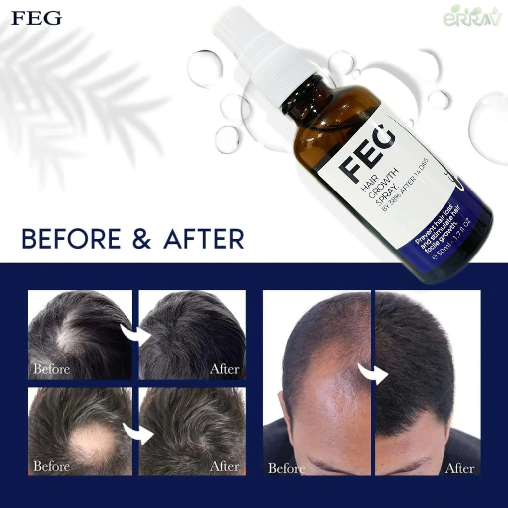 FEG Plus Hair Spray – Regrow & Strengthen Your Hair