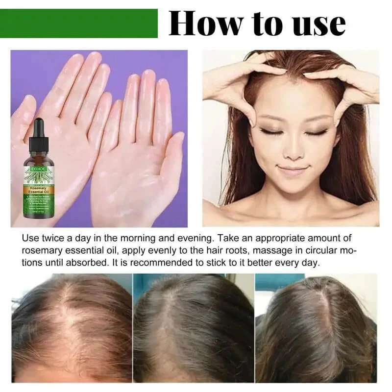 Rosemary Hair Oil – Grow Strong, Healthy Hair Naturally